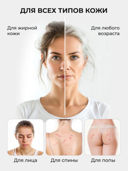 Сыворотка Ниацинамид Пептиды от прыщей и акне ACNE KILLER — изображение 13
