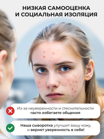 Сыворотка Ниацинамид Пептиды от прыщей и акне ACNE KILLER — изображение 4