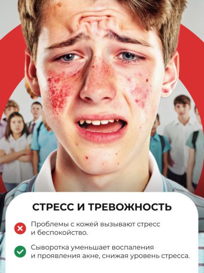 Сыворотка Ниацинамид Пептиды от прыщей и акне ACNE KILLER — изображение 5