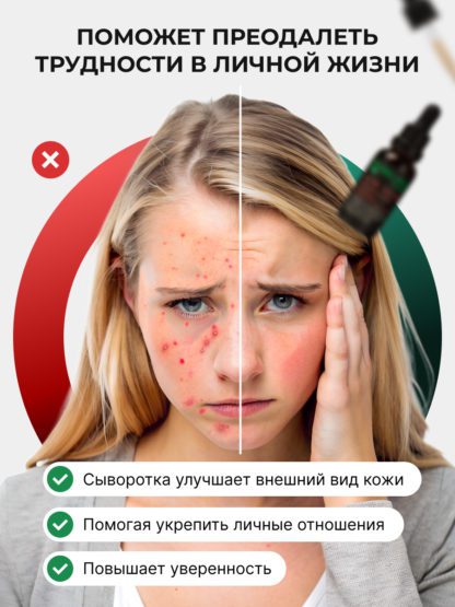 Сыворотка Ниацинамид Пептиды от прыщей и акне ACNE KILLER — изображение 7